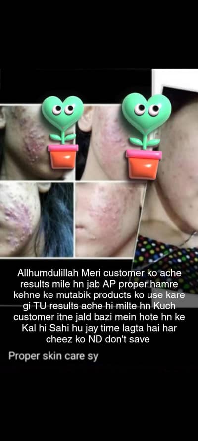 skin care product/ Acne set/4 in 1