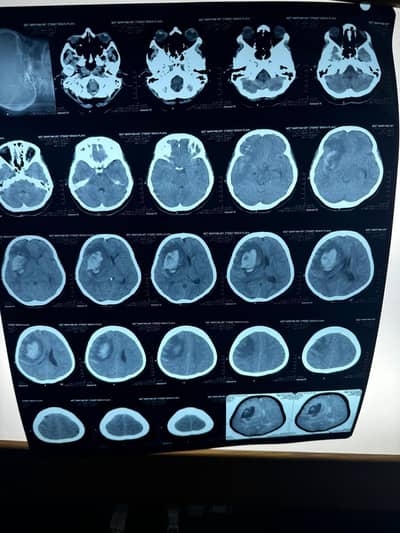 Tele-medicine, health advise