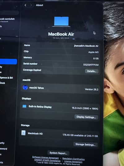 10/10 condition just buy 6 months ago bearly used 100% health