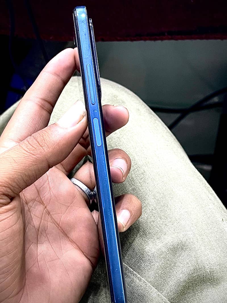Redmi note 11 7