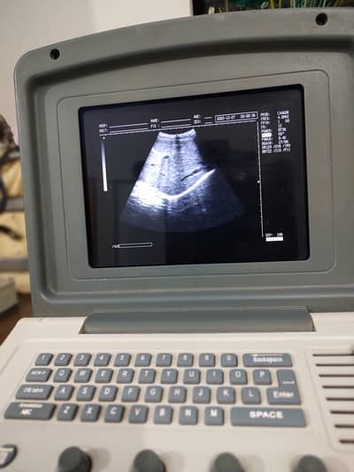 Biocare ultrasound machine