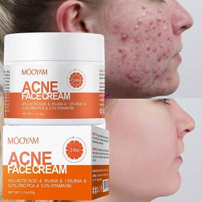 چہرے کے دانوں کا کرے حاتمہ