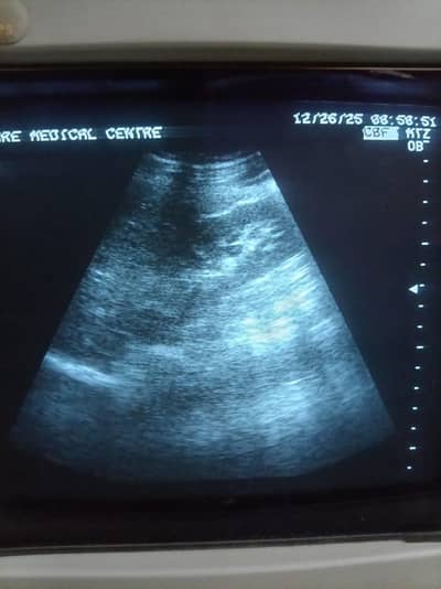 ultrasound
