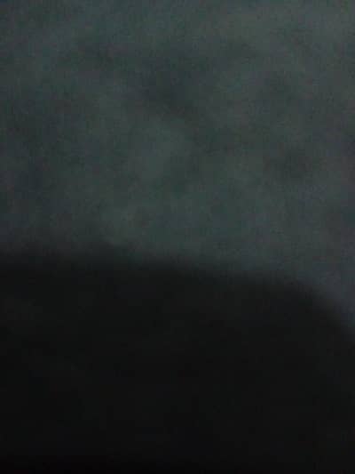 B positive blood available