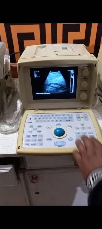 ultrasound machine