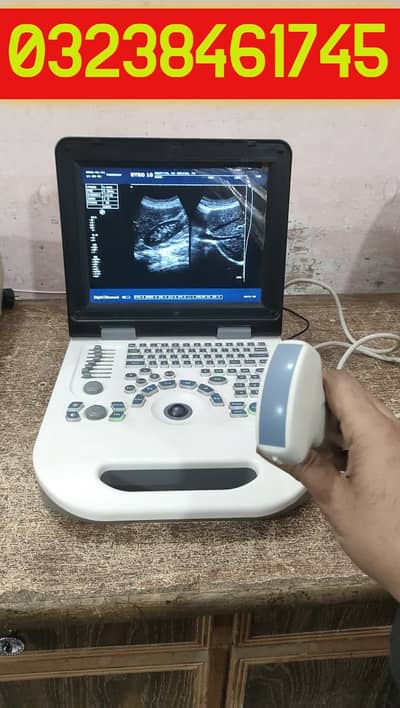 used china nyro 10 portable ultrasound machine with battery backup