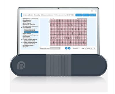 Wellue ECG Monitor, Professional Holter Recorder