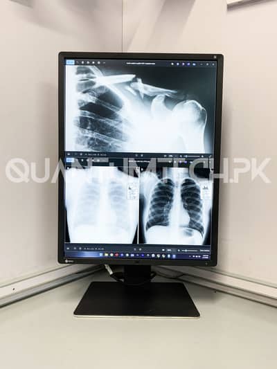 22inch EIZO RadiForce RX350 Diagnostic 3MP Medical Radiology Monitor