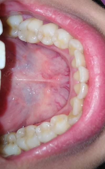 Dental Surgeon Required