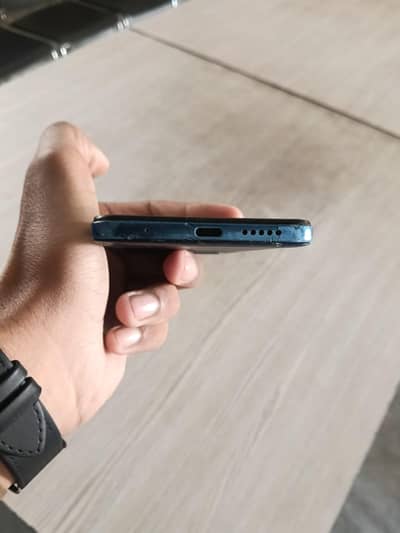 Redmi Note 11 ha good condition back sa kula ha  Baki thak ha