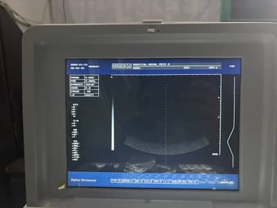 Ultrasound and all Hospital Items for sale