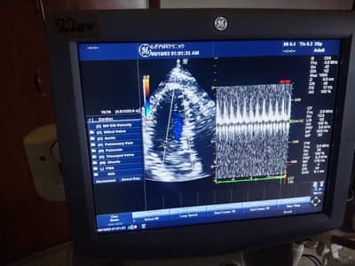 GE Logiq P5 Ultrasound Machine for sale