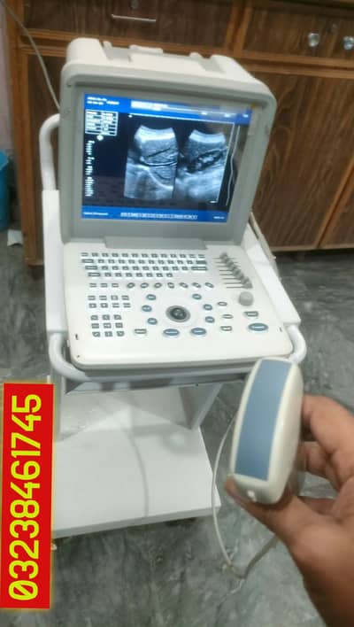used china Apollo 7 ultrasound machine like new condition