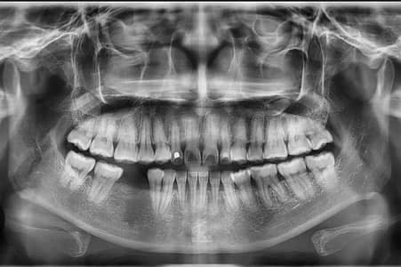 need dental surgeon Ali town adiala road