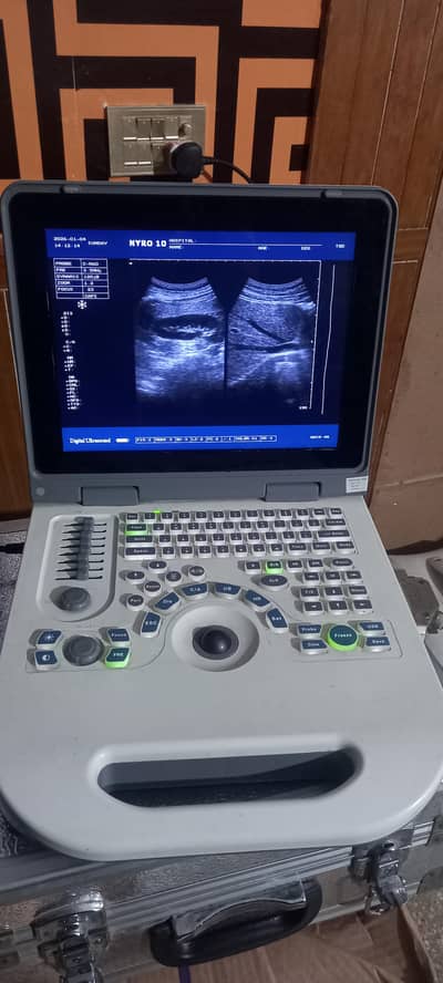 Ultrasound machine Nyro-10 Labtop style available for Sale  whts