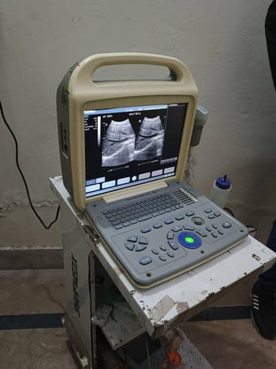 Use portable Ultrasound Machine