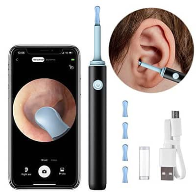 Ear Wax Removal With HD Camera