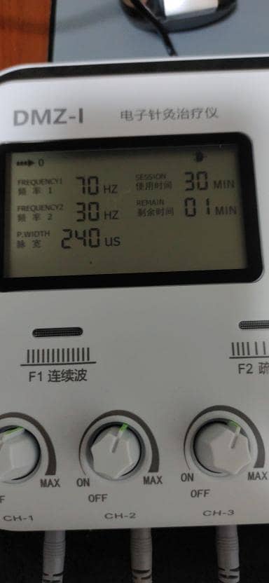 Acupuncture Needle Body Muscle Stimulator Physiotherapy TENS