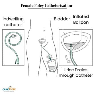 Home care nursing services available limited area