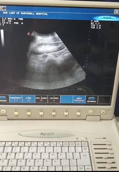 color Doppler ultrasound
