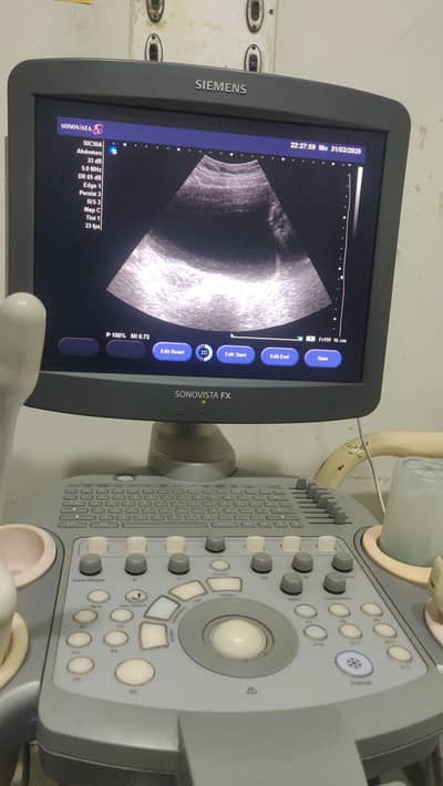 siemens sonovista fx color dopler ultrasound