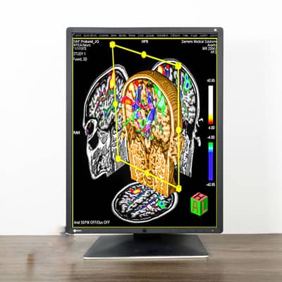 Eizo RadiForce RX360 22inch 3MP Medical Diagnostic Radiology Monitor