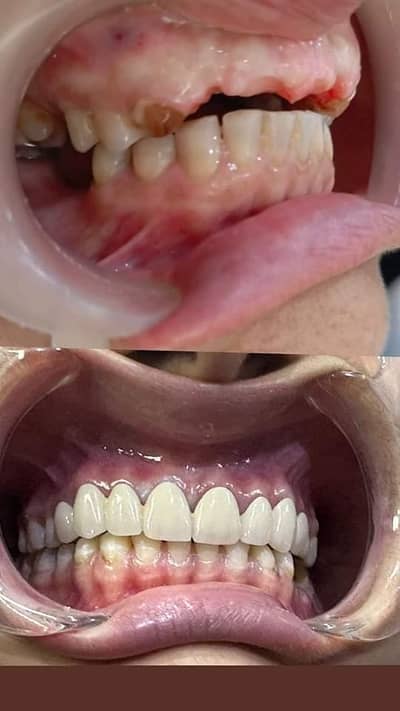 i need female dentle tecnition