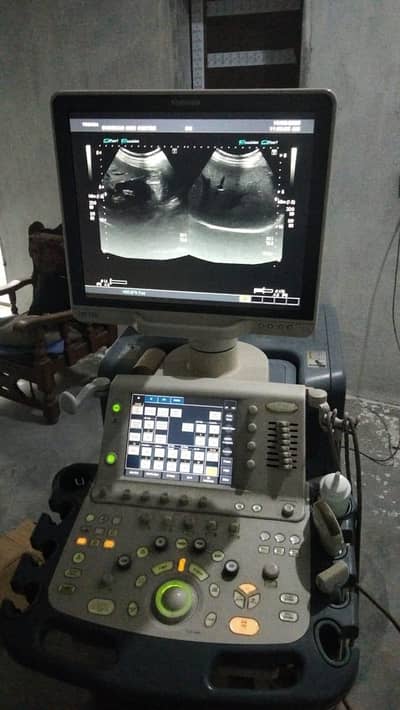 Doppler Ultrasound machine with probe and printer backup