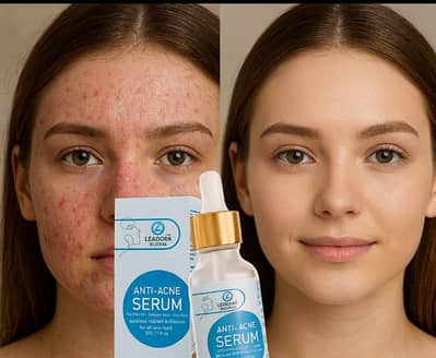 Anti-Acne Serum