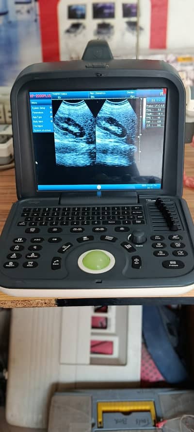 Slightly used ultrasound sound machine. . in 9.5/10 condition