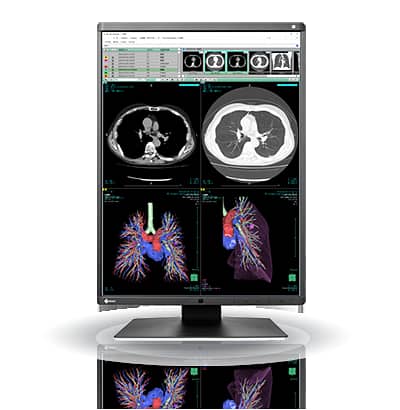 Eizo RadiForce RX360 22inch 3MP Medical Diagnostic Radiology Monitor ...