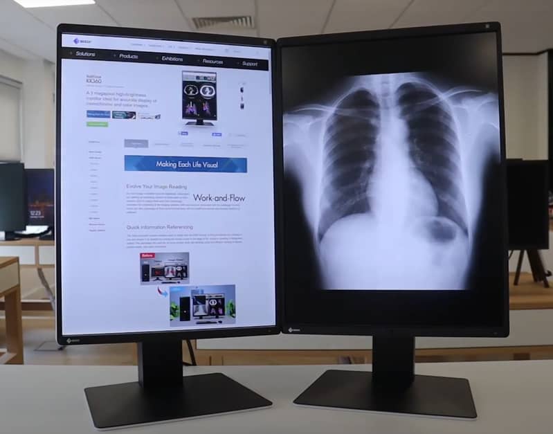 Eizo RadiForce RX360 22inch 3MP Medical Diagnostic Radiology Monitor ...