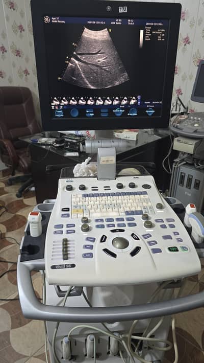 GE Vivid S6 Echo and Ultrasound machine for Sale
