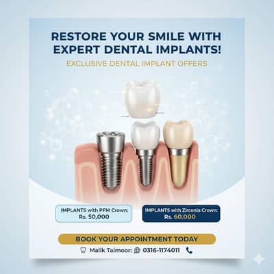 Dental Implants