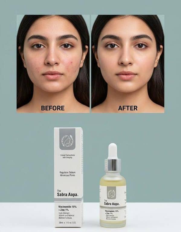 Sabra Aapa Oil Control Serum 30ml