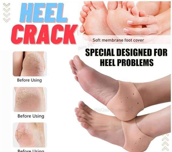 Silicone Gel Heel Pad Socks For Pain Relief And Anti Crack Heel 1 Pair Heel Cups Heel Guards Heel Protectors Heel Sleeves For Relieve Heel Pads Cushion Heel Pain, Heal Dry Cracked Heels, Achilles Tendinitis, For Men & Women