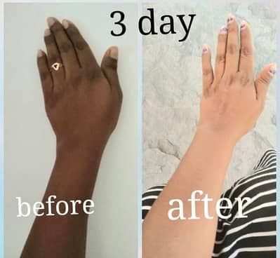 hands face feet whitening beauty cream . .