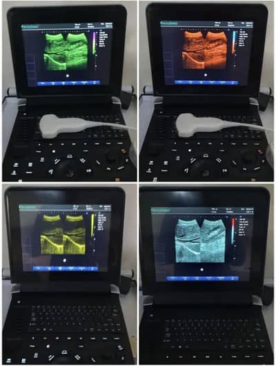 PeriodMed Battery Backup Ultrasound