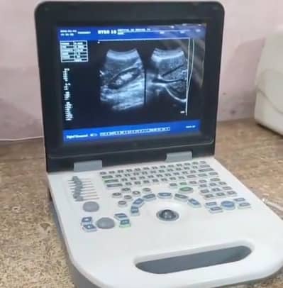 oriel plus altrasoud macin for sale