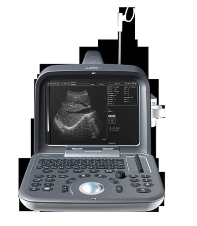 Ultrasound Machines  Brand new - Portable ultrasound |Color ultrasound