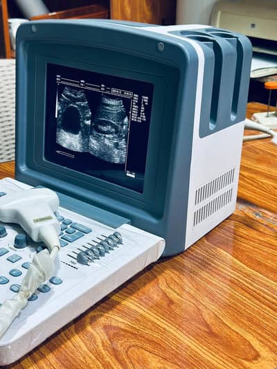 China portable ultrasound Noyadex_N8