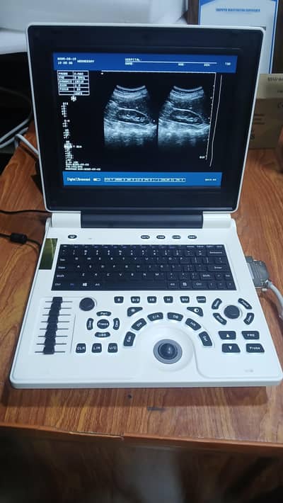 Brand new China  ultrasound machine
