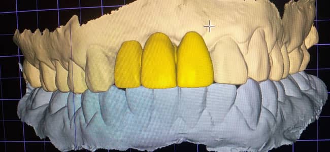 female dental assistant