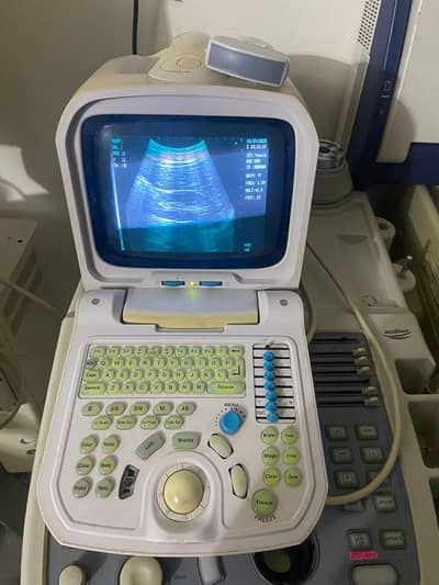 ultrasound machine Chinese portable for sale