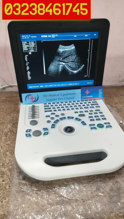 new china nyro 10 portable ultrasound machine with battery backup