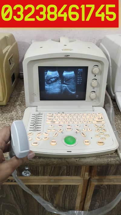 used china oriel ultrasound machine in low price
