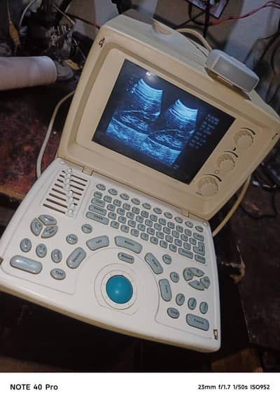 new & used ultrasound machine for sale