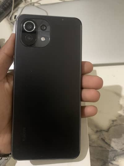 xiaomi 11 lite complete box