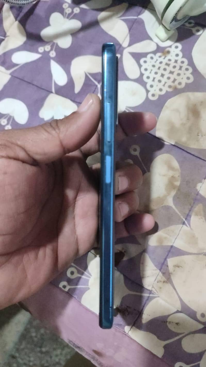 Redmi note 11 3
