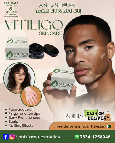 Vitiligo Skincare Cream